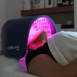 Traitement des vergetures par LED chez Hemera, institut de beauté à Lille