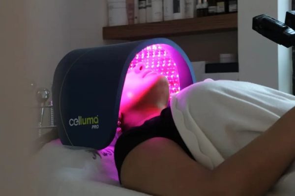 Traitement des vergetures par LED Traitement des vergetures par LED chez Hemera, institut de beauté à Lille