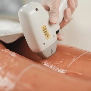 Épilation des demi-jambes à la lumière pulsée chez Hemera, institut de beauté à Lille