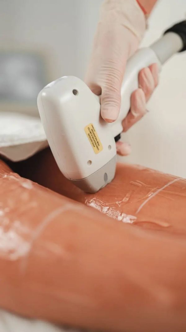 Épilation des demi-jambes à la lumière pulsée Épilation des demi-jambes à la lumière pulsée chez Hemera, institut de beauté à Lille