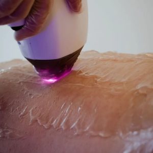 Épilation du maillot homme à la lumière pulsée chez Hemera, institut de beauté à Lille